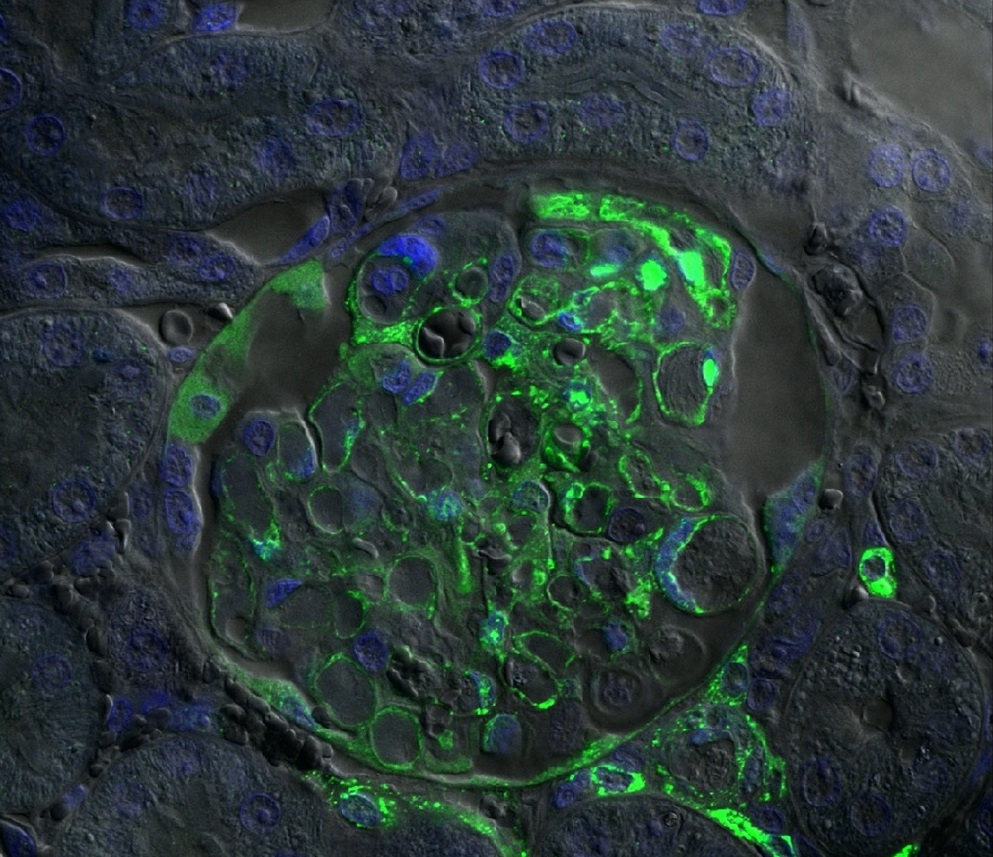 Microscopic blue and green image of a ferret's kidney infected with Hendra virus