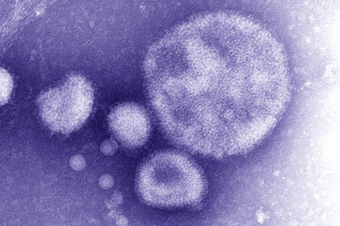 Electron micrograph image of H7N9 Avian Influenza Virus