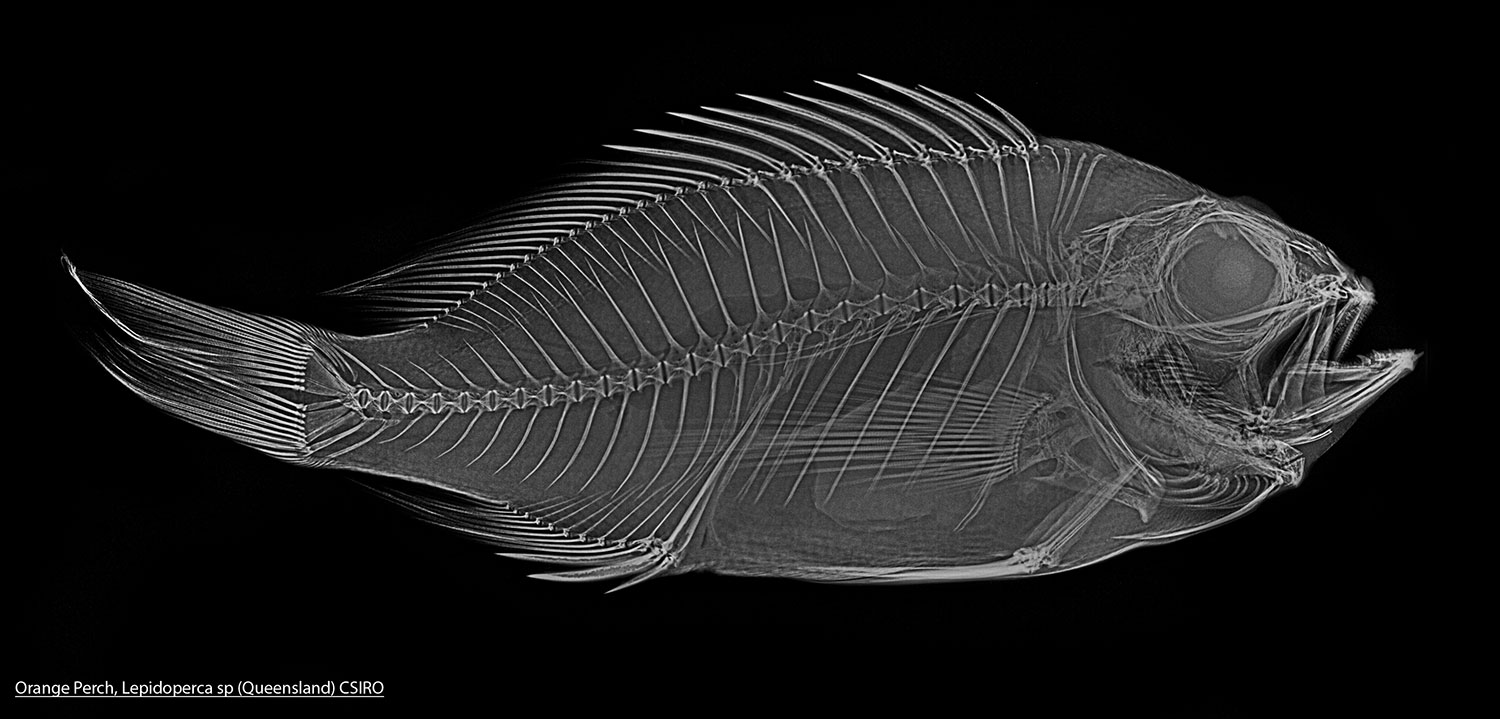 Digital X-ray of the orange perch. The numbers and arrangements of skeletal elements of fishes (such as vertebrae and fin rays) are often unique to individual species.