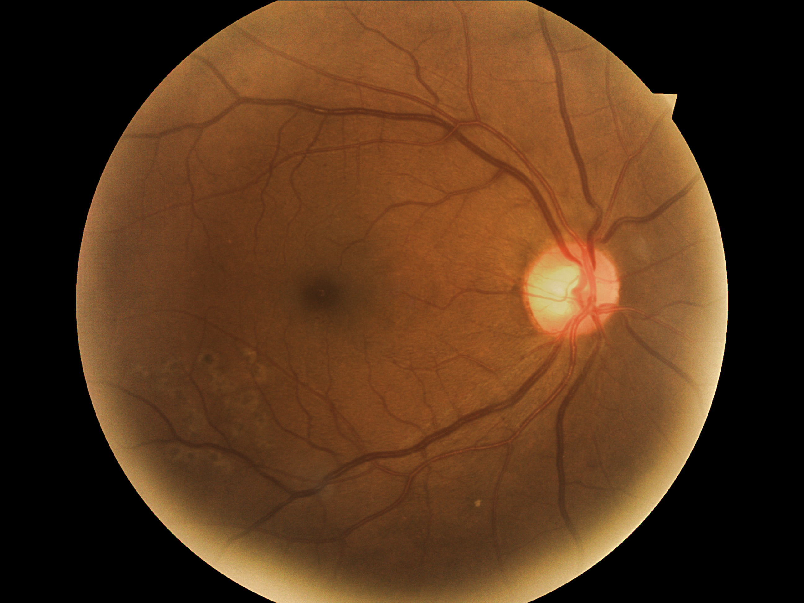 A retinal image