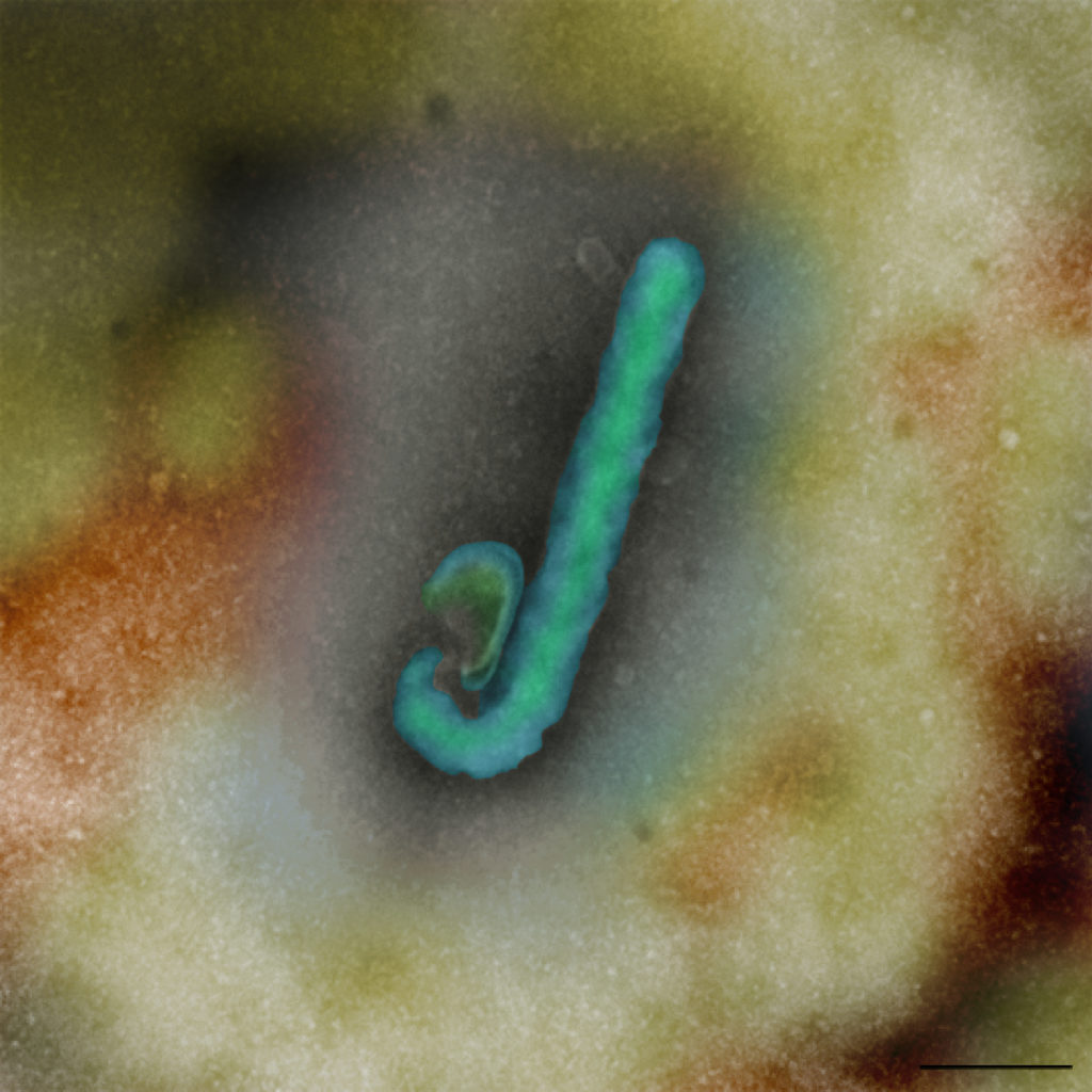 An artificially coloured electron microscope image of Ebola virus .