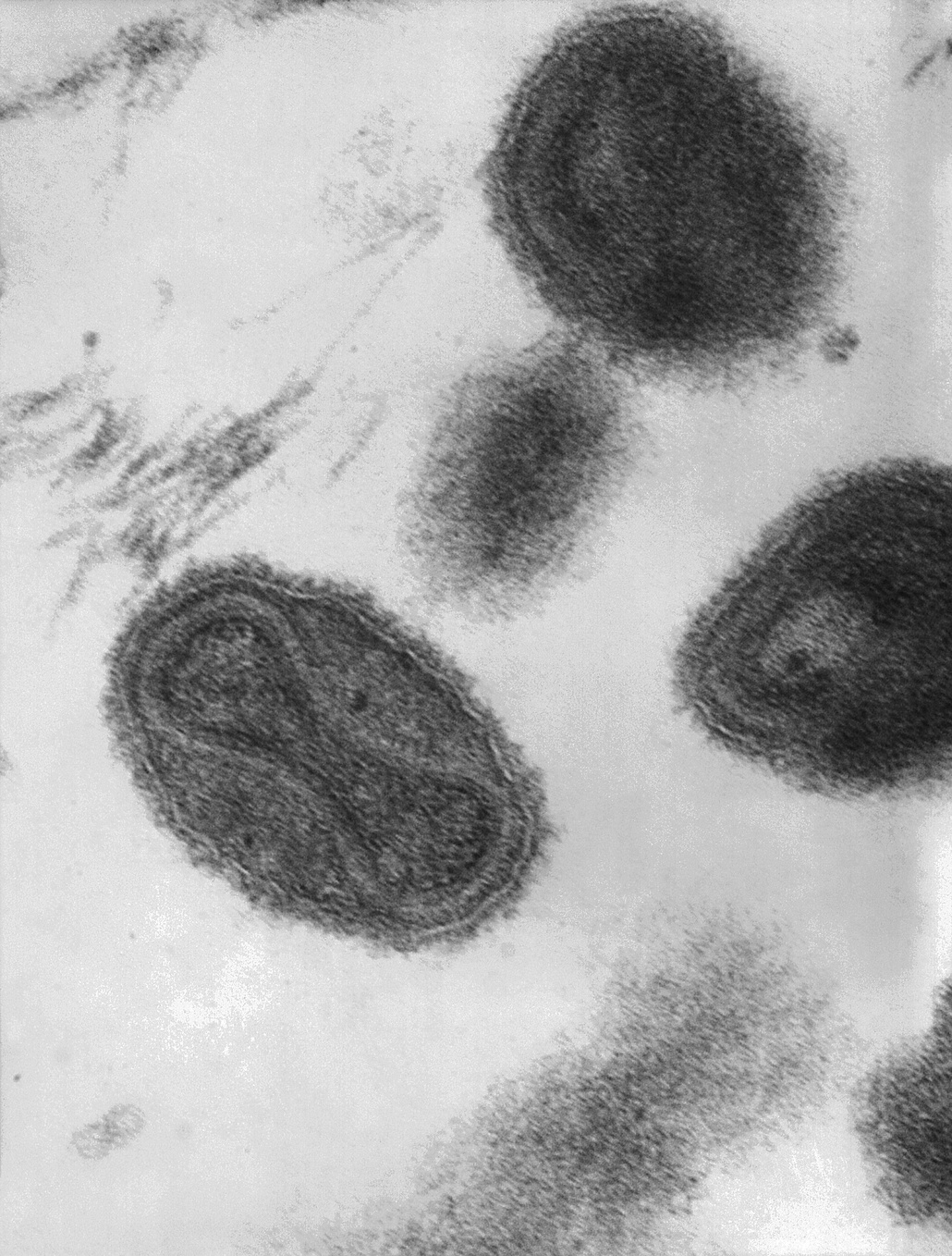 The dumbbell-shaped structure inside smallpox contains viral DNA. Image: Centres for Disease Control and Prevention's Public Health Image Library