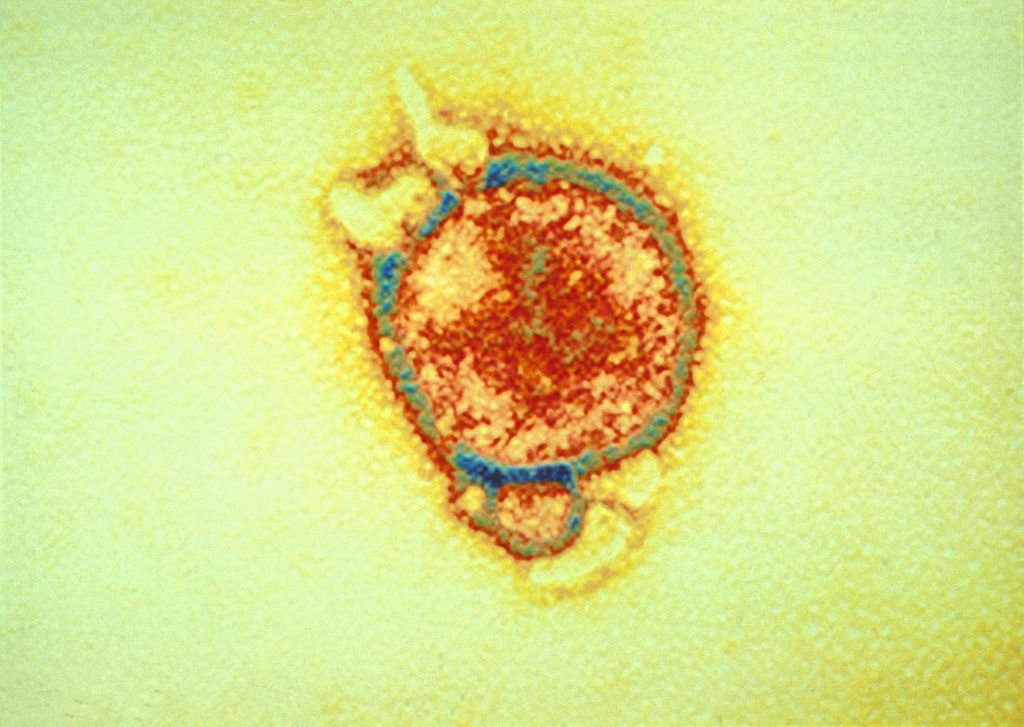 a micriscopic image of Hendra virus - bright organge cellular shape encapsulated in bright blue ring on yellow background
