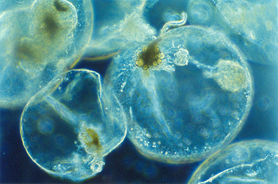 Microscopic image of Noctiluca scintillans