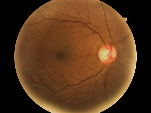 Medical service via email: an image of a patient's retina can be easily sent to an ophthalmologist. 