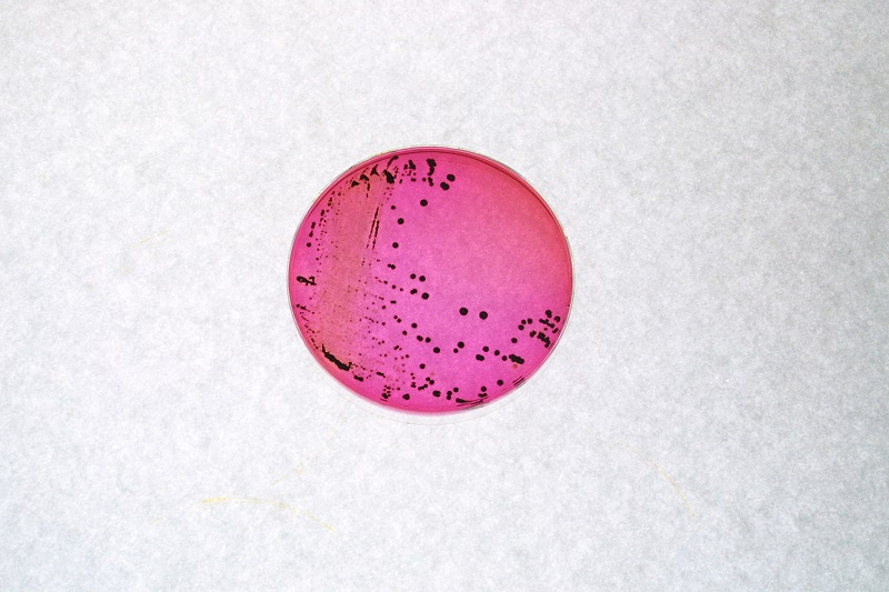 Salmonella colonies on agar. 