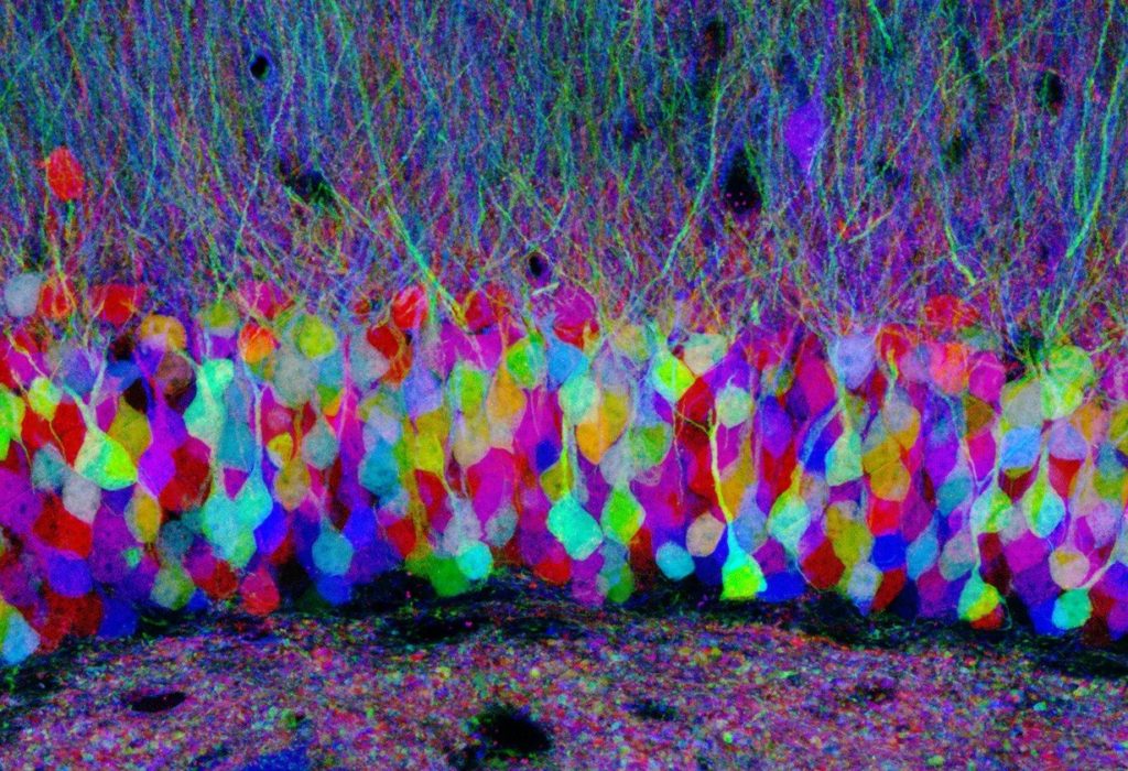http://www.cellimagelibrary.org/images/42753 Description: Confocal image of pastel neurons in the hippocampus of a "Brainbow" mouse brain, with each neuron expressing a distinct color. In Brainbow mice, neurons randomly choose combinations of red, yellow and cyan fluorescent proteins, so that they each glow a particular color. This provides a way to distinguish neighboring neurons and visualize brain circuits. Honorable Mention, 2007 Olympus BioScapes Digital Imaging Competition. Authors: Jean Livet and 2007 Olympus BioScapes Digital Imaging Competition®