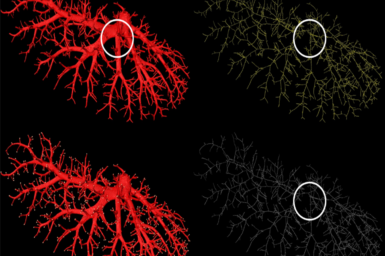 Dadong et al. blood vessel branching algorithm