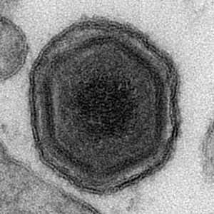 A hexagon shaped virus particle with five rings of different coloured tissue.