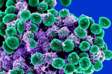 Staphylococcus epidermidis, superbugs, antibiotic resistance, polymer, peptides. ©National Institute of Allergy and Infectious Diseases, M. Otto