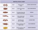 Is My Gut Healthy Csiroscope