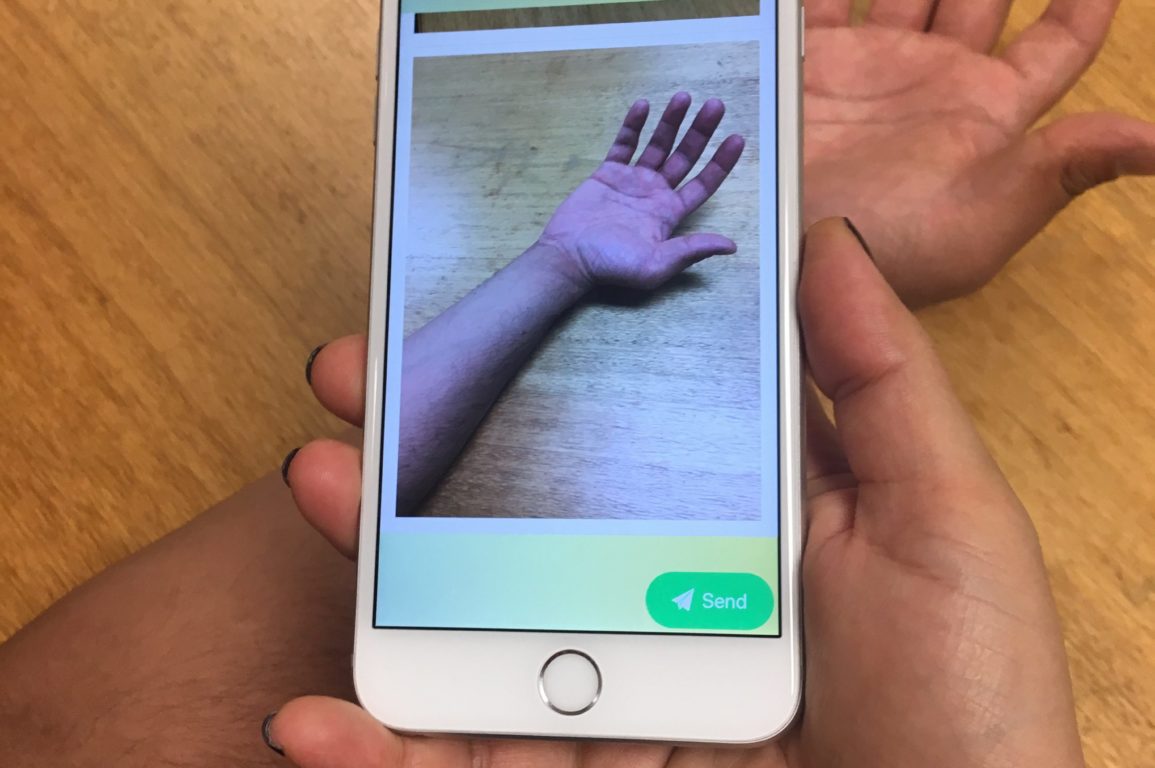 A photo of the MICE app in action - a doctor takes a photo of a patient's burn to send to the specialist.