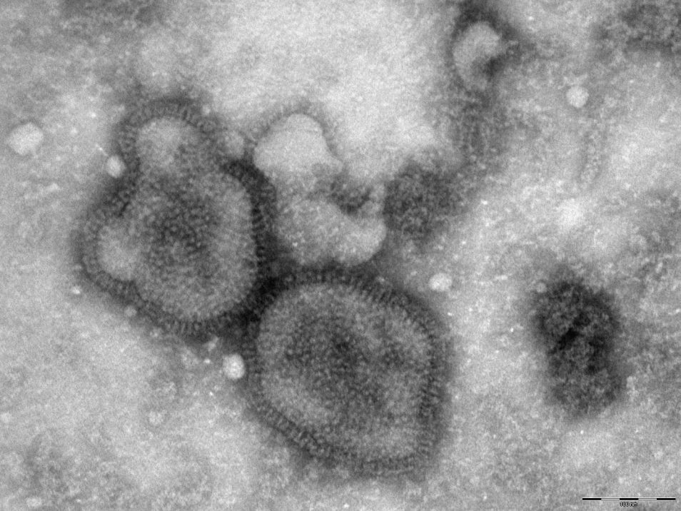 A microscopic image of the H1N1 influenza virus.