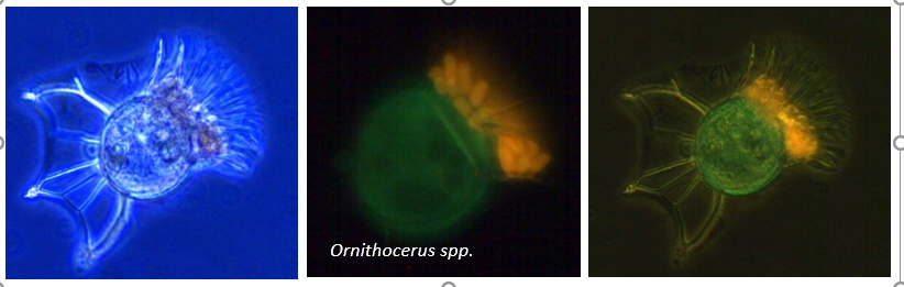 microscopic picture of Phytoplabkton Ornithocerus spp