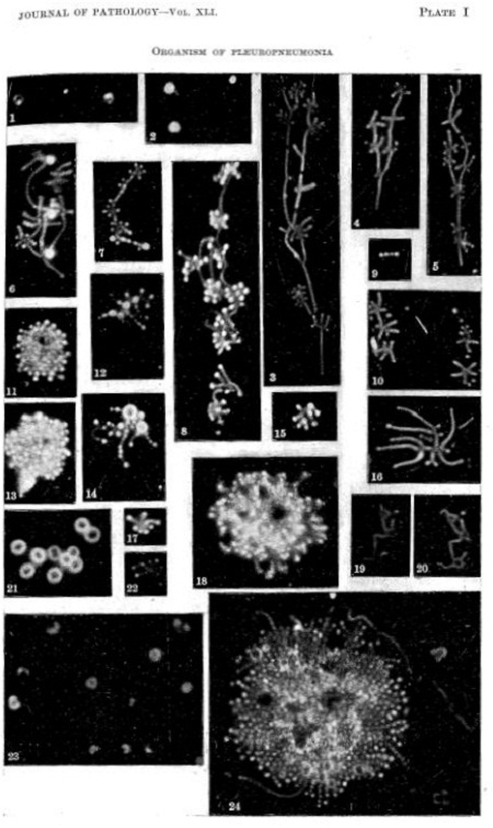 black and white microscope images of disease