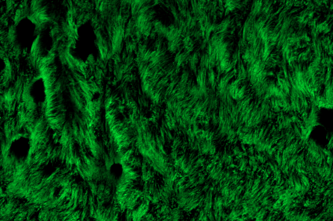 Lab-grown airway cells (cilia) stained green.