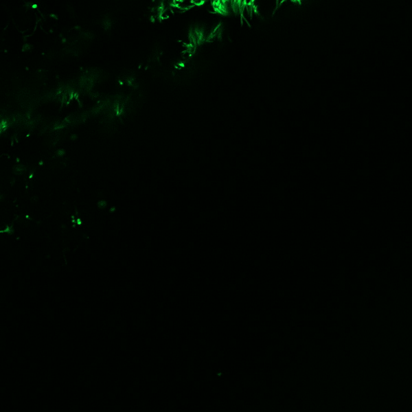 Lab-grown airway cells stained green.
