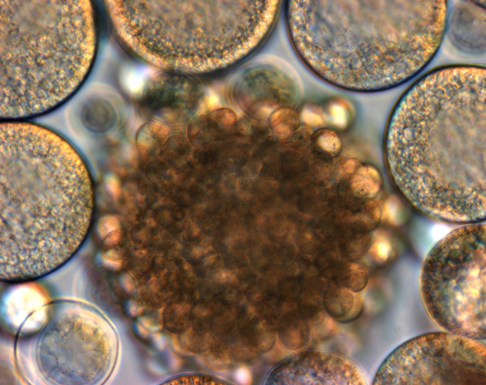 Micrograph close-up of Thraustochytrid