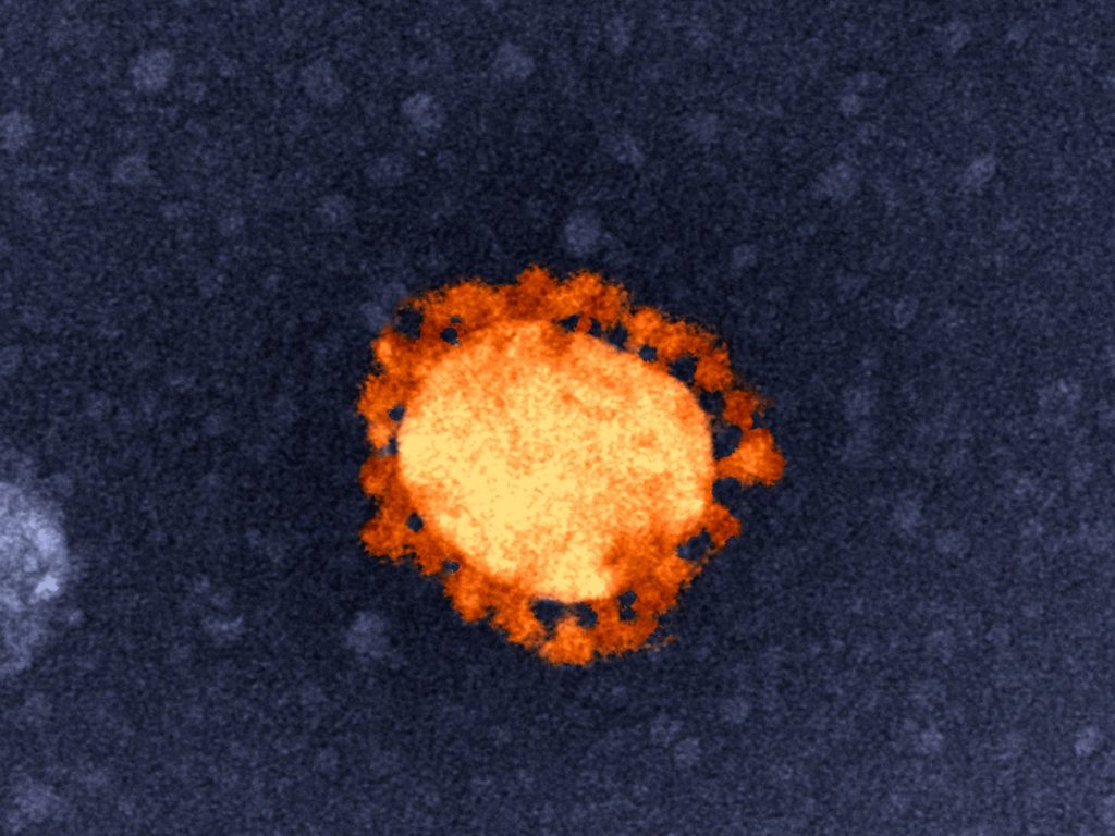 An image of SARS-CoV-2
