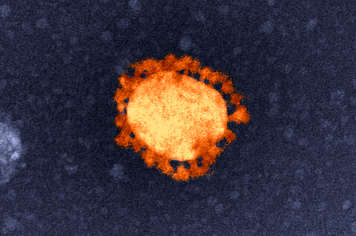 A SEM of a SARS-CoV-2 virus.