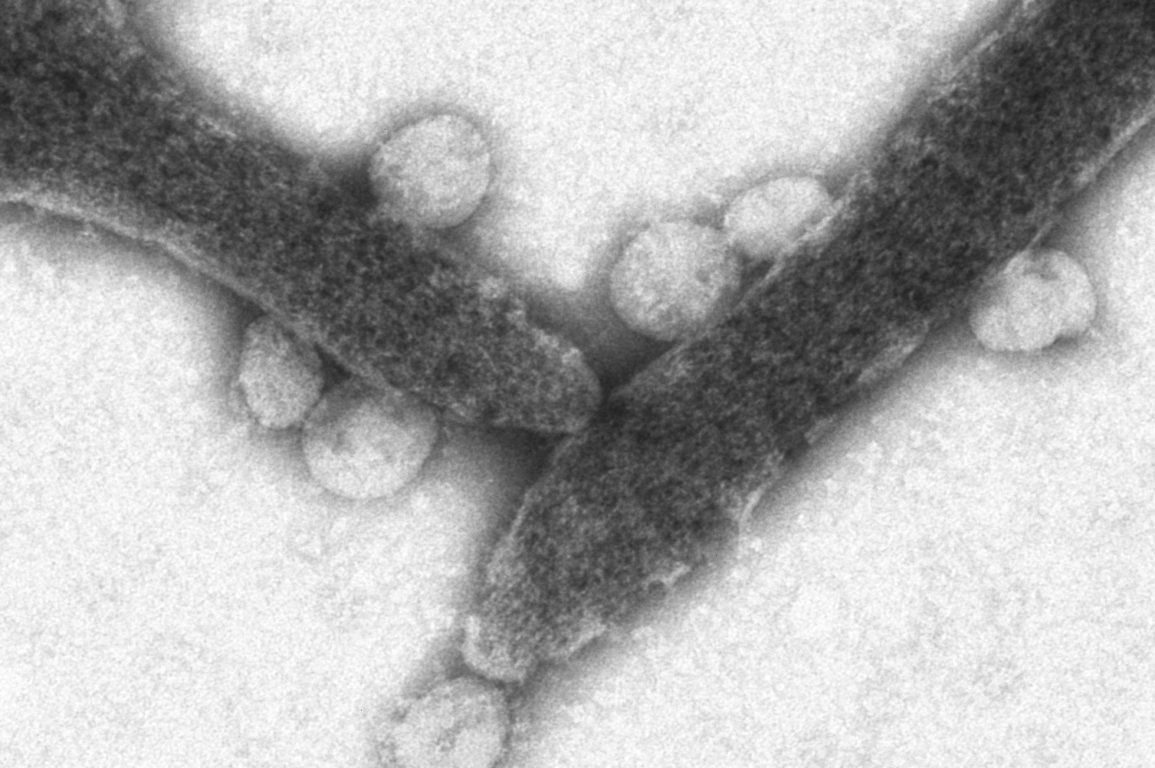 Black and white microcopy image of the SARS-CoV-2 virus.