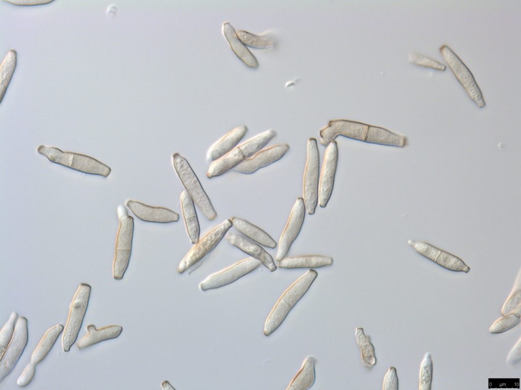 A microscopic image of the sea spurge biocontrol fungus, Venturia paralias