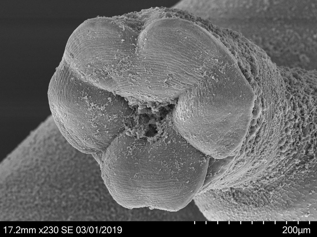 A microscopic view of Enenterum petrae.