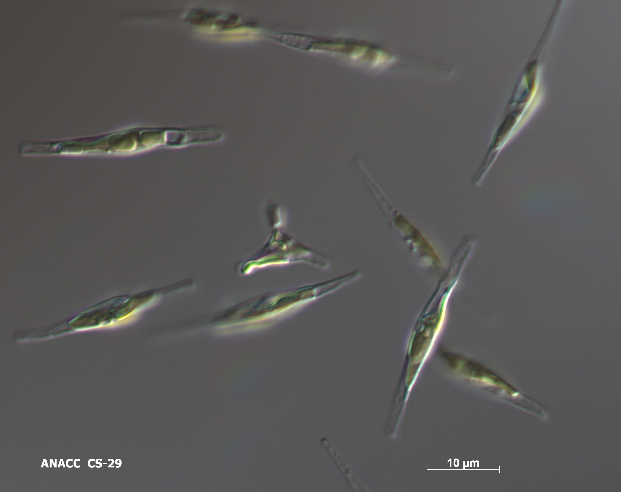 CS29 Phaeodactylum are seen at x1000 magnification against a grey background.