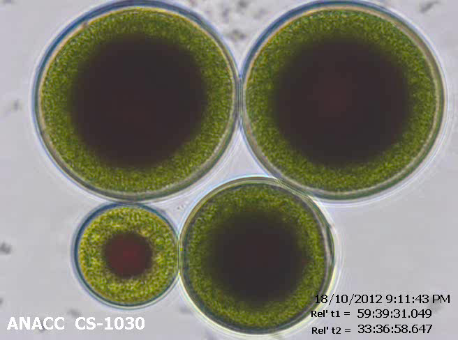 Microscopic image of Haematococcus cysts. 
