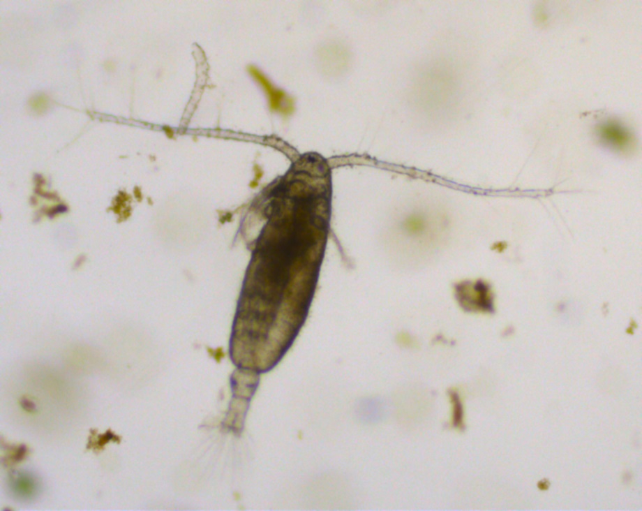A tiny, prawn-like animal viewed under a microscope. 